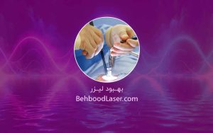 🎯 لیزر درمانی یا درمان‌های خانگی؟ بررسی تفاوت‌ها و اثربخشی روش‌های مختلف در درمان هموروئید و شقاق